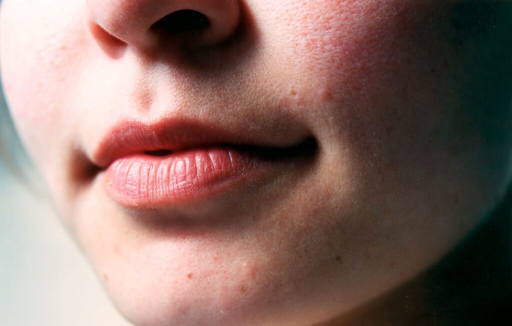 Close-up image highlighting a woman's lips and natural skin texture, focusing on facial features.